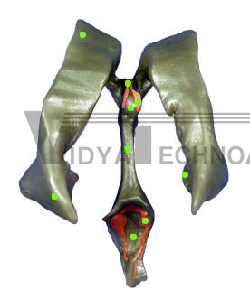 Cerebral Ventricles-Posterior View